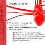 arteria carótida