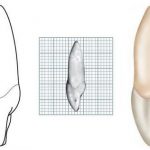 ICS-MESIAL