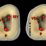 2-molar-entrada-dos-canais