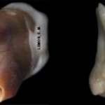 2 molar irrompimento temrino rizogênese