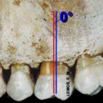 molar sup arco dentario