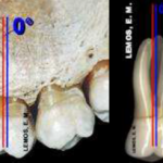 molar sup posição arco