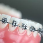 why-orthodontics