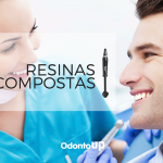 RESINAS COMPOSTAS