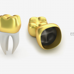 odonto up protese total metalica