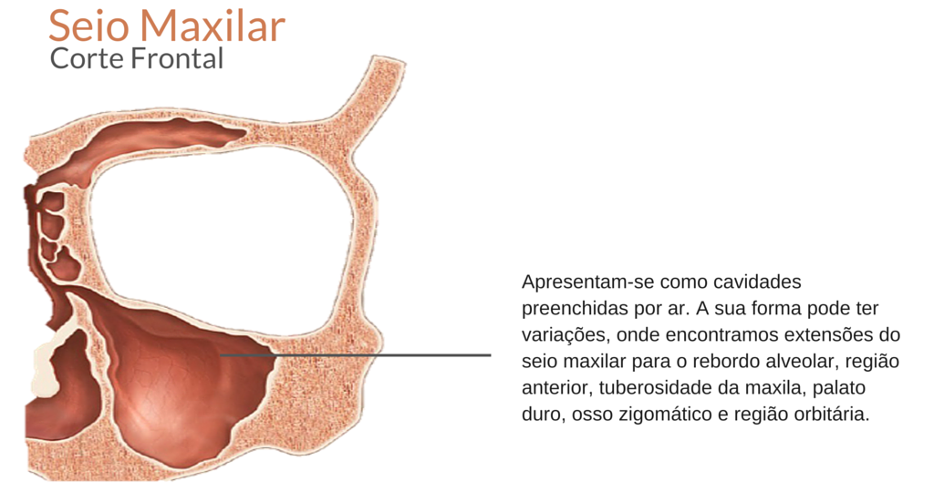 Anatomia da Maxila – Odonto Up