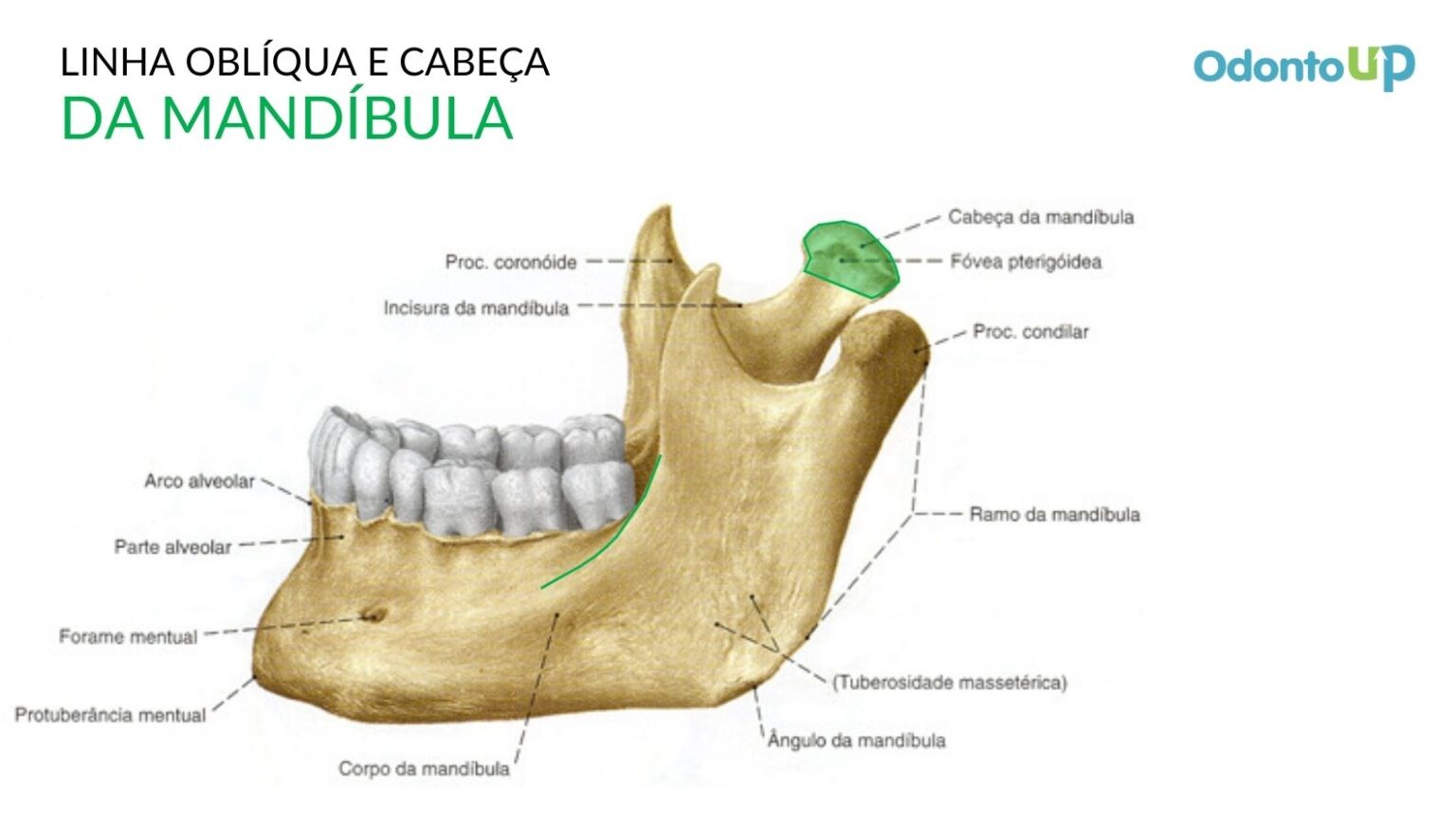 Como hacer que mi mandibula se marque